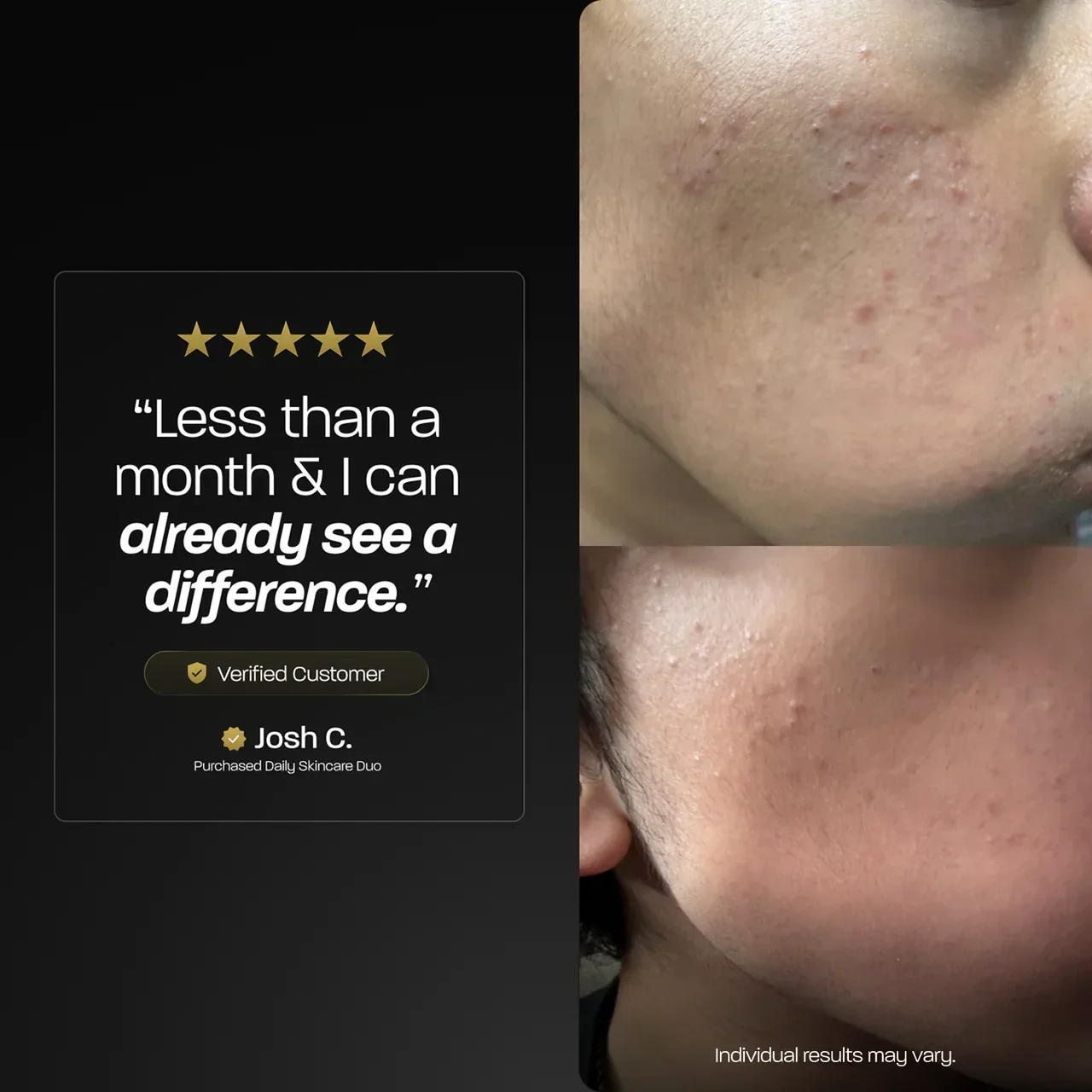 BASED Daily Skincare Duo - side angle for men UK